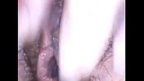 Exploring a beautiful hairy pussy with medical endoscope have fun