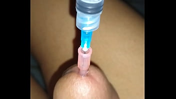 Впрыскивание воды в пенис с помощью катетера